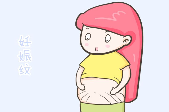产后妊娠纹明显，什么方法可以帮助淡化